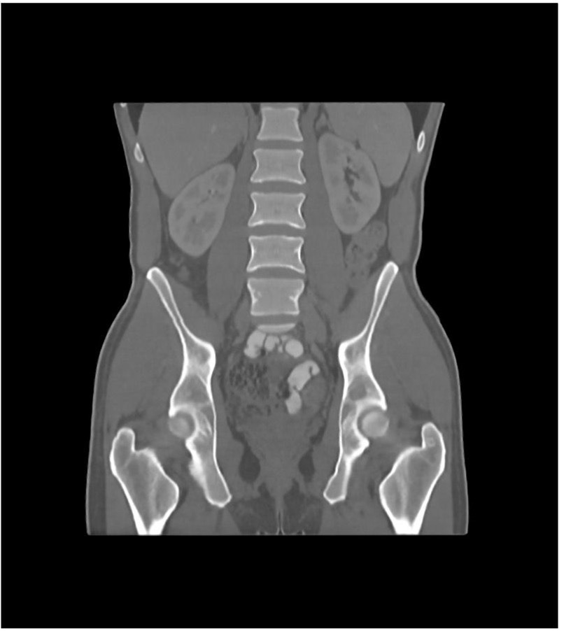 Phantoms behave like (simulated) humans in CT and thus allow CTs to be verified and validated without exposing “real” patients to radiation.