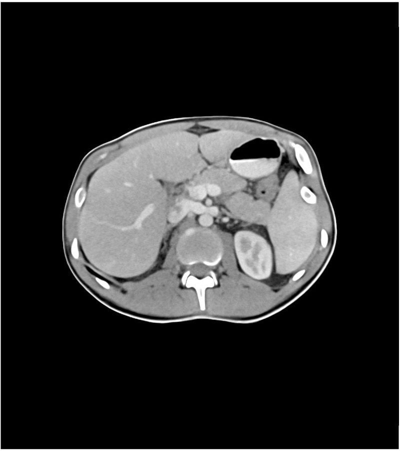 The images obtained with phantoms are (almost) indistinguishable from “real” images and thus help to simulate patients.